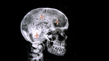 preview HistoryOfTheMainComplaint 05