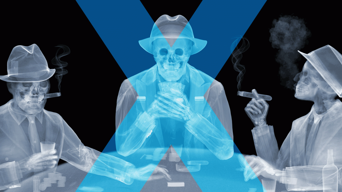 X RAY neu
