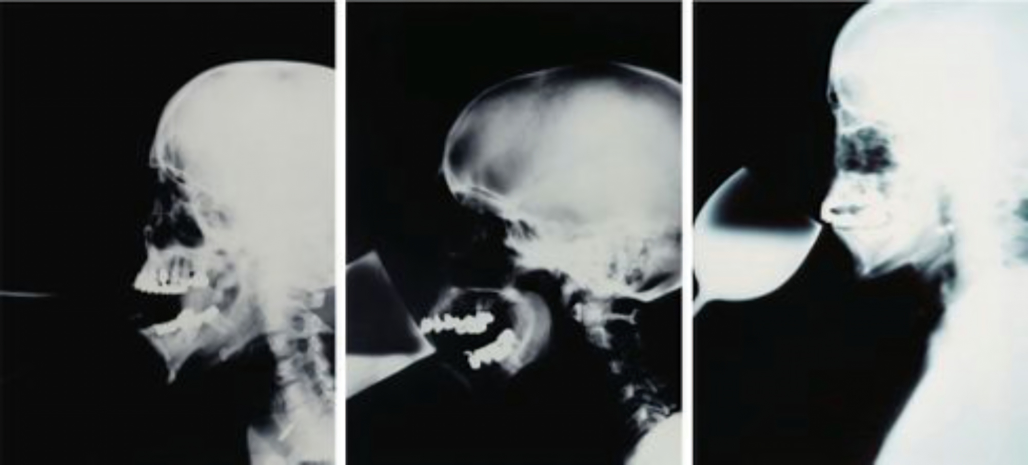 isa genzken 3 roentgen aufnahmen vergr upscale 2000